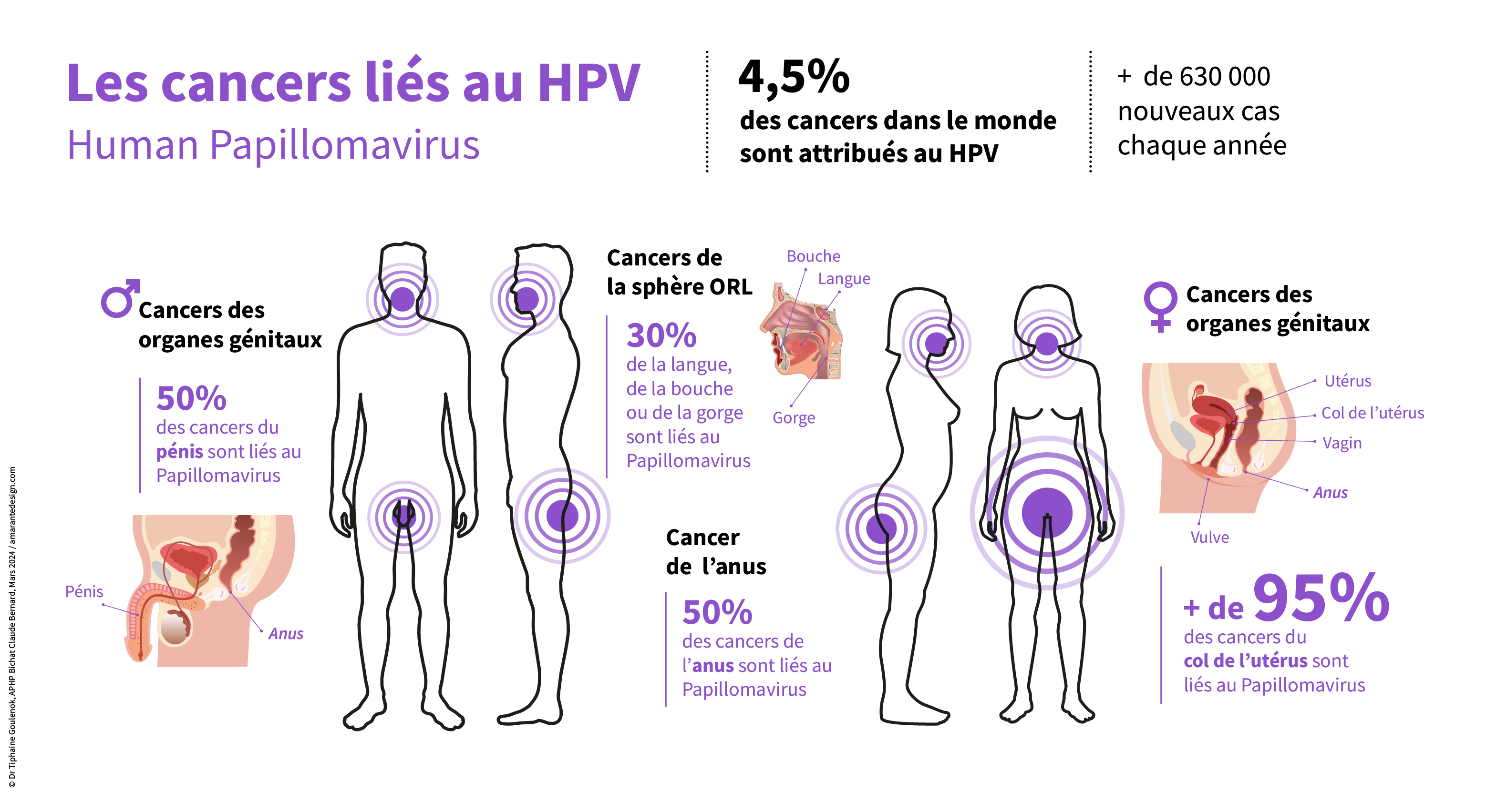 Infographie-PourcentageHPVcancers